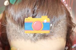 -大麦微针植发全国连锁