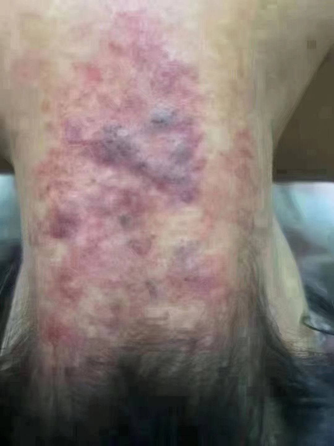 到了春天排毒的季节了哦!