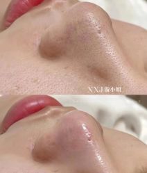-蕾特恩专业祛痘·皮肤管理