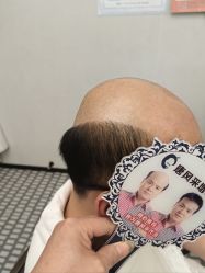 -唐风采假发补发定制