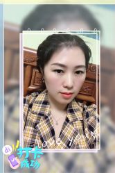 -大麦微针植发全国连锁