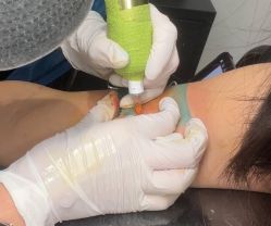 -明星刺青·洗纹身