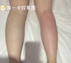 -Lily纤美·科技减脂中心