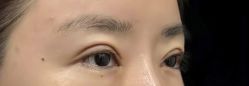 点击看大图 -Yestar 嘉兴艺星医疗美容医院