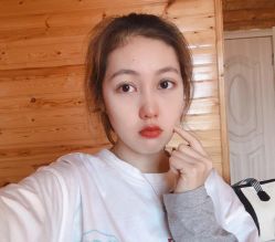 点击看大图 体验前-广东韩妃整形外科医院