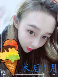 -大麦微针植发全国连锁