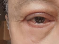 -广州美莱医疗美容医院