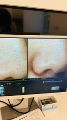 -苑苑vbeauty科技美容SPA