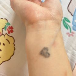 点击看大图 体验后-杭州奥拉克医疗美容门诊部