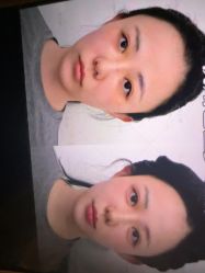 -Yestar杭州艺星医疗美容医院