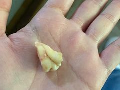 -浙江大学医学院附属第一医院(庆春院区)