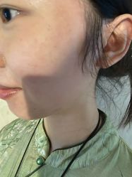-四川米兰柏羽医学美容医院