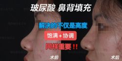 -北京米扬丽格医疗美容·联合丽格鼻整形中心