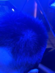 体验前-碧莲盛·不剃发植发