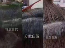 -希梵尔头皮抗衰·科技养发
