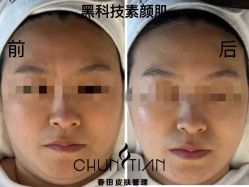 -春田皮肤管理中心品牌旗舰店