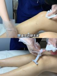 -植蔻妍倍儿专业脱毛·皮肤管理