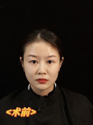 -云南吴氏嘉美医疗美容医院