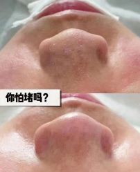 -资医堂·除疤祛痘祛斑