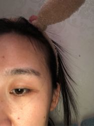 -痣清宫祛斑祛痣连锁店