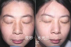 -上海漾颜医疗美容