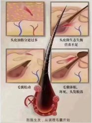 -侗秀养发•头疗