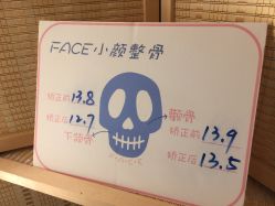 -FACE·日本小颜矫正美容整骨サロン