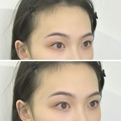 -张小野·专业半永久纹眉