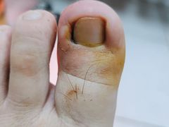 -新甲连锁灰指甲·甲沟炎·鸡眼(黑龙江路店)