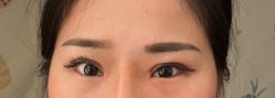 体验后-天津伊美尔医疗整形美容专科医院