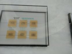 点击看大图 -新生植发·植养护一体