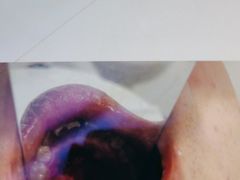 -宁波壹加壹口腔·矫正种植中心