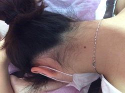 -晶奕空间专业脱毛连锁机构