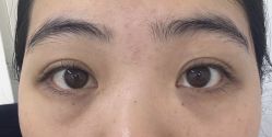 体验前-杭州米兰柏羽医疗美容医院