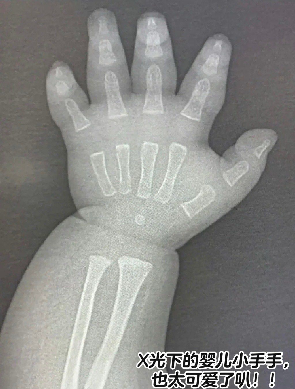 x光下的婴儿小手手,也太可爱了叭