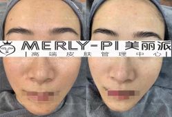-MLP美丽派·问题肌疗愈中心