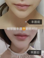 -上海漾颜医疗美容