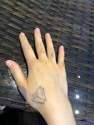 -天道专业洗纹身