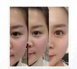 -东森自然美.INDIBA.美容SPA.皮肤管理