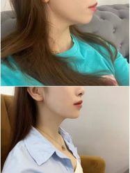 点击看大图 -深圳美莱医疗美容医院