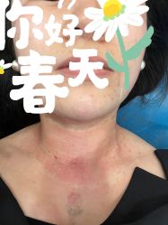 -More摩尔医美の注射线雕光电中心