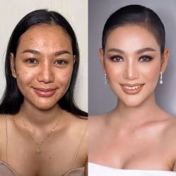 -美肤盾祛痘·问题肌头疗管理中心