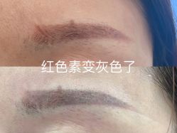 点击看大图 -张小野·专业半永久纹眉