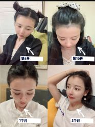 -雍禾植发全国连锁