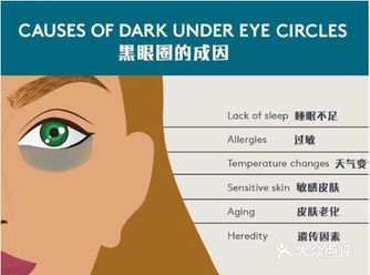 ND：YAG激光，消除扩张的毛细血管网