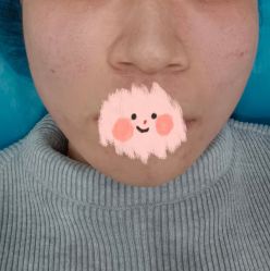 体验后-澳尔颜选医疗美容