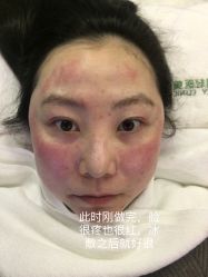 体验后-繁星轻医美连锁