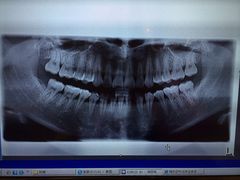 iphone_upload_pic-瑞尔齿科(上海长风大悦城店)