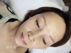 -西施无菌半永久纹绣眉眼影唇轻增发纹发际线