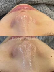 -E.beauty驻颜·痘敏肌调理中心